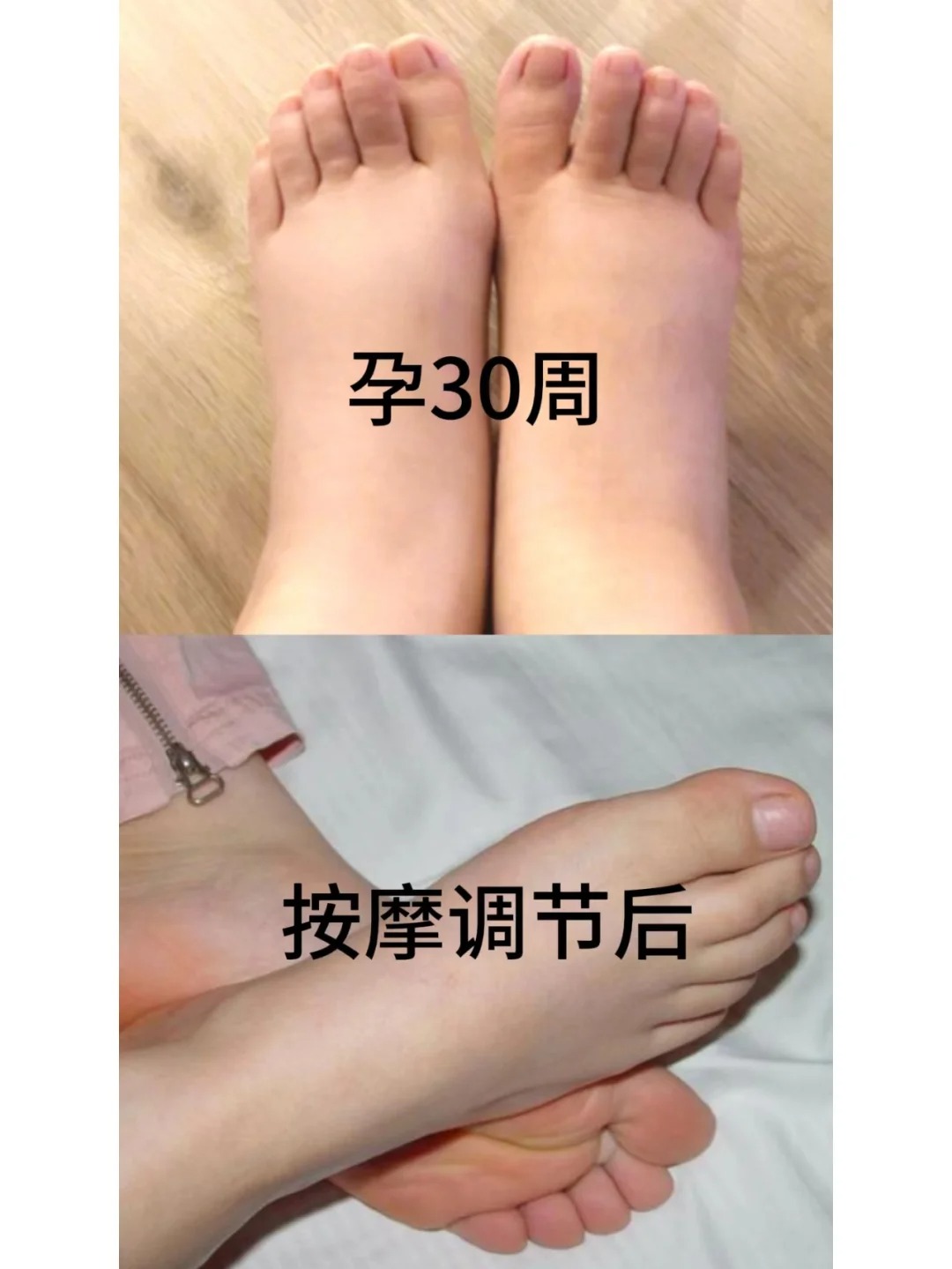 孕期保养小秘诀_一招解决孕期水肿_2_漂亮妈妈孕产护理连锁品牌_来自小红书网页版.jpg