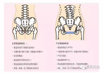 骨盆修复，漂亮妈妈来拯救你的大PP！！